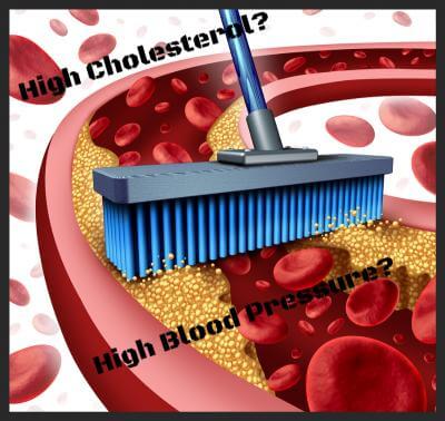Cholesterol- High Blood Pressure